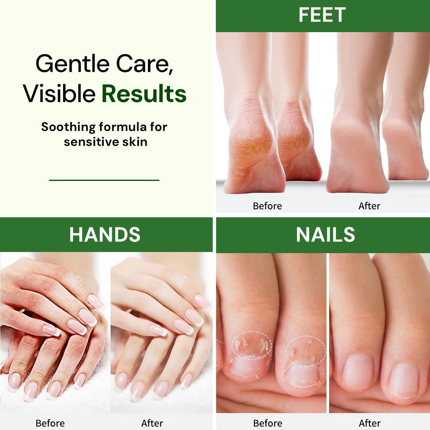 Natural Hand Foot Nail Cream