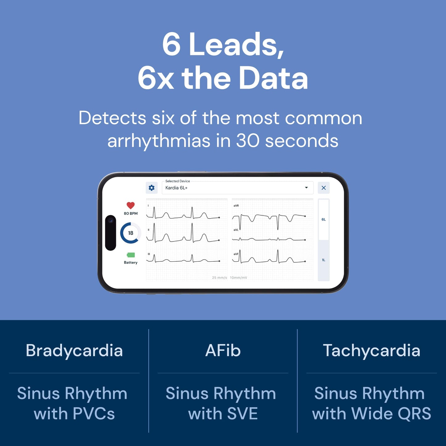 6L Portable ECG Heart Monitor