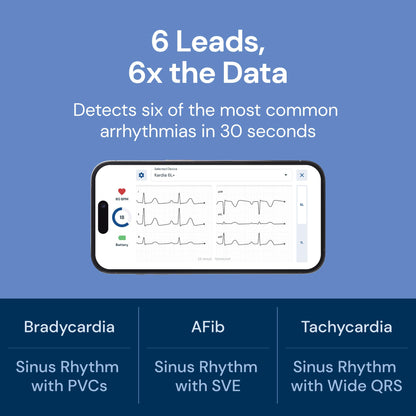 6L Portable ECG Heart Monitor