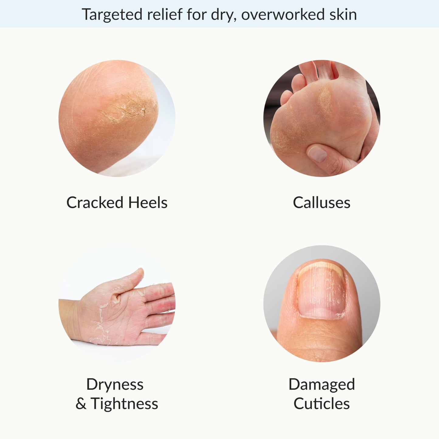 Repairing Hand and Foot Mask Set