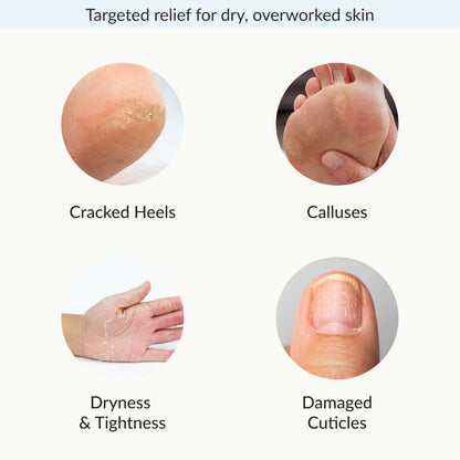 Repairing Hand and Foot Mask Set