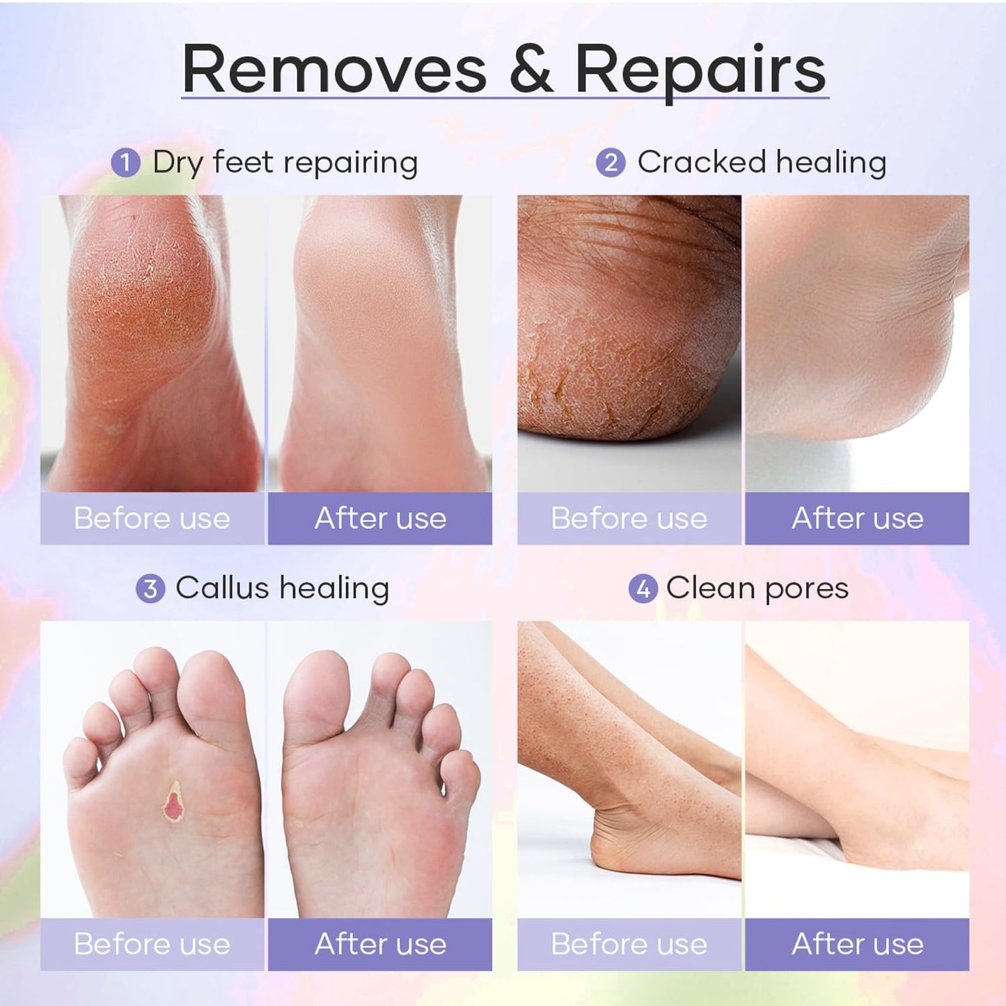 5-Step At Home Pedicure Spa Kit