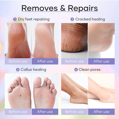 5-Step At Home Pedicure Spa Kit