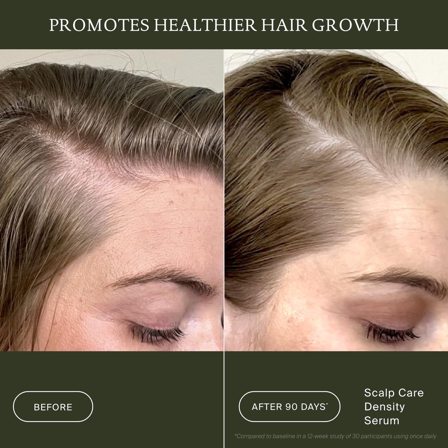 Living Proof Scalp Care Density Serum