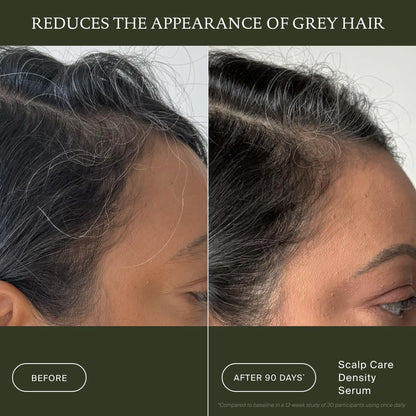 Living Proof Scalp Care Density Serum