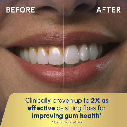 Aquarius Water Flosser Dental Care