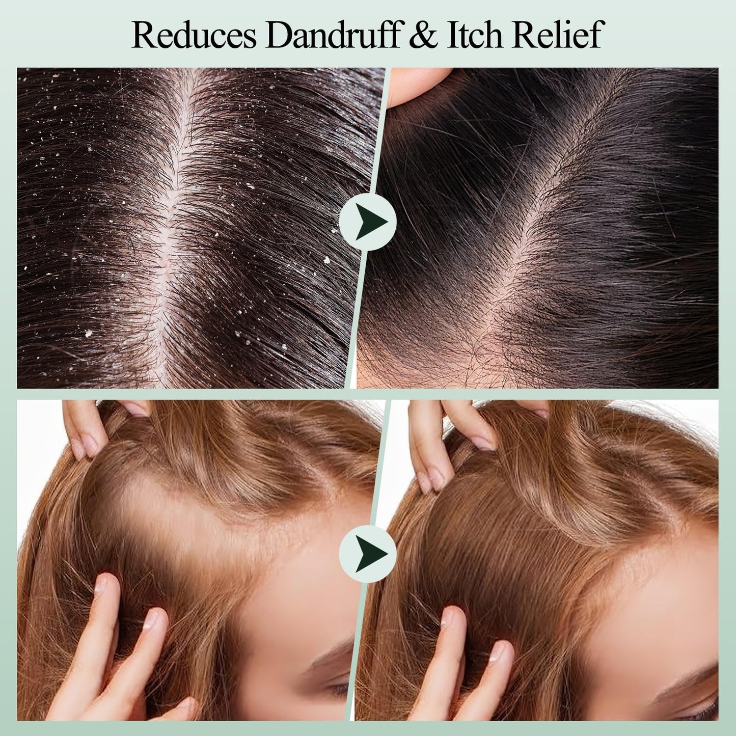 Rosemary Scalp Exfoliating Scrub Treatment