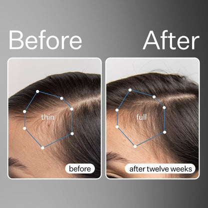 Apple Stem Cell Scalp Serum Treatment